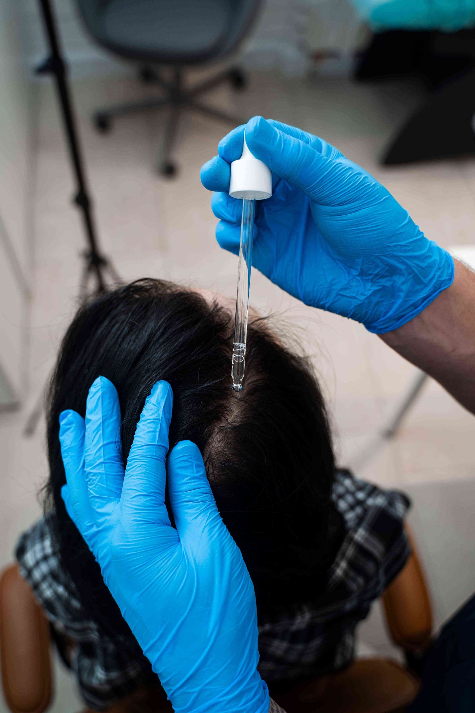 Homeopathy for Hair Conditions